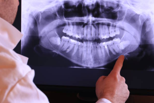 Best Emergency Dentist for Lost Fillings or Crowns in Lincoln University, PA