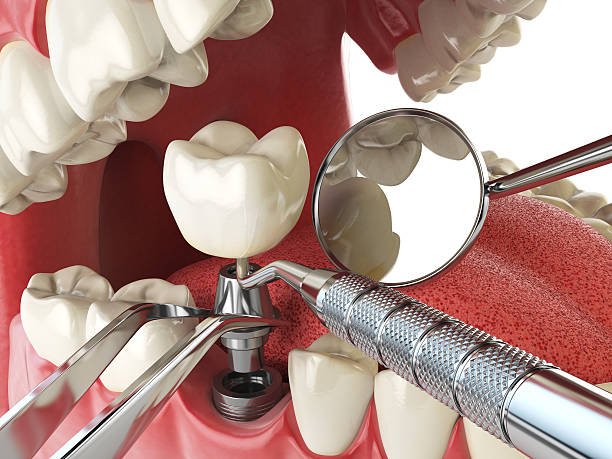 Best Emergency Dentist for Lost Fillings or Crowns in Lincoln University, PA